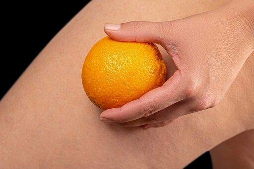 pelle a buccia d'arancia su gamba donna